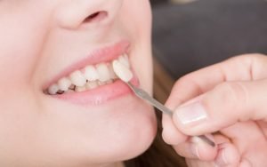 What kinds of things can dentists do